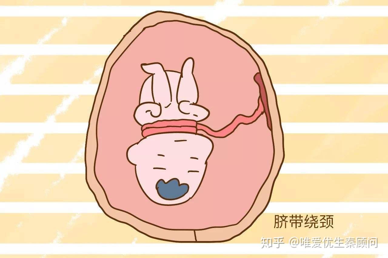脐带绕颈最新观察，自然美景的心灵之旅探索