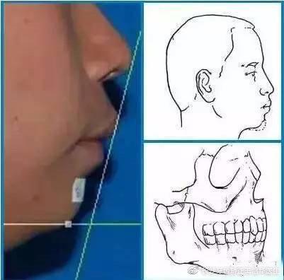下巴短的女明星的友情与陪伴的温馨日常